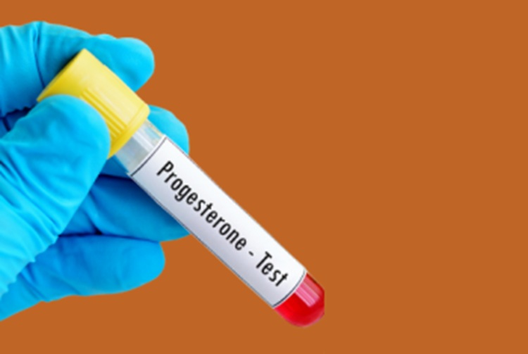 progesterone