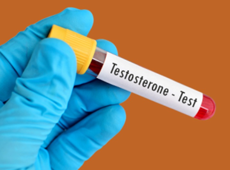 testosterone-