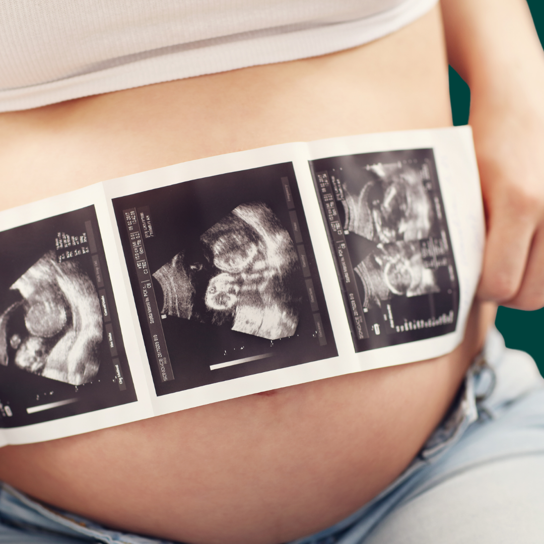 ultrasound-in-pregnancy Ultrasound in pregnancy