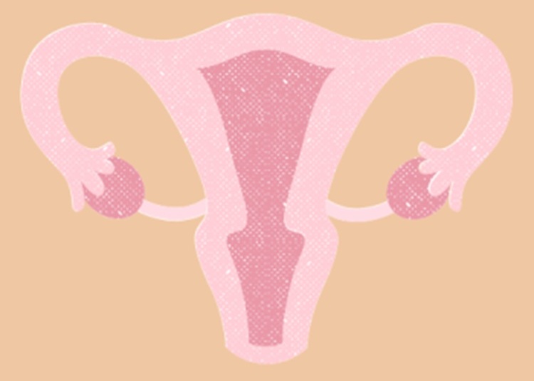 uterine-factor-infertility